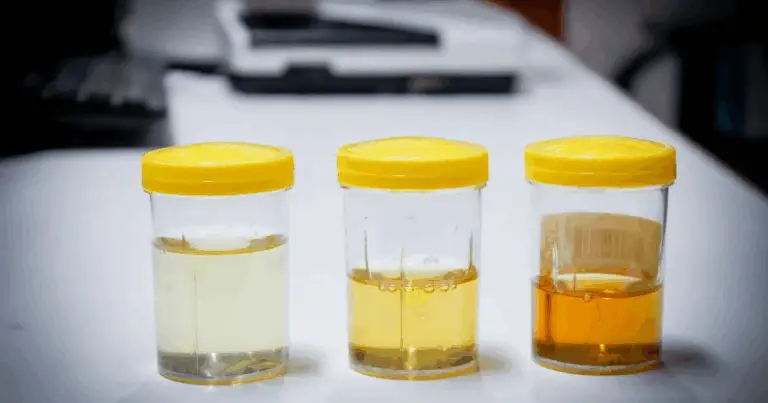 Cosa la Colore dell’Urinare Può Rivelare sul Tuo Corpo 💧