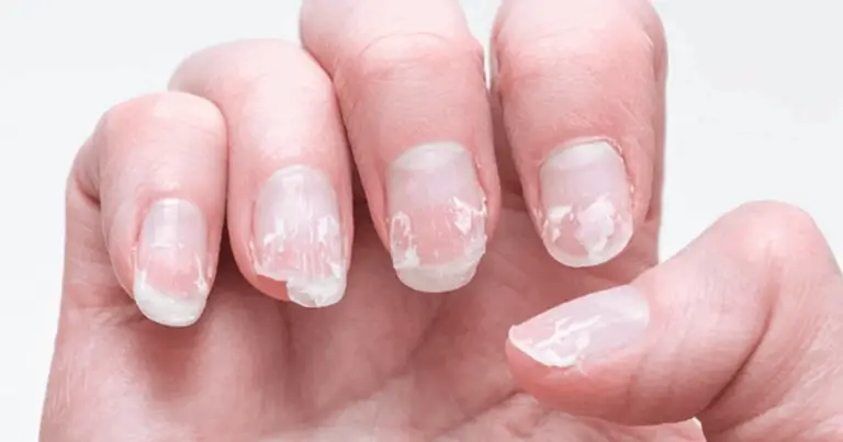 Le Unghie Parlano: Guida Completa per Decodificare i Segnali della Tua Salute