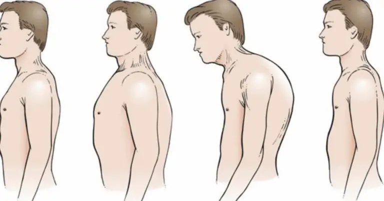 Segnali Chiave: Come Riconoscere Segni Fisici Indicativi di Malattie