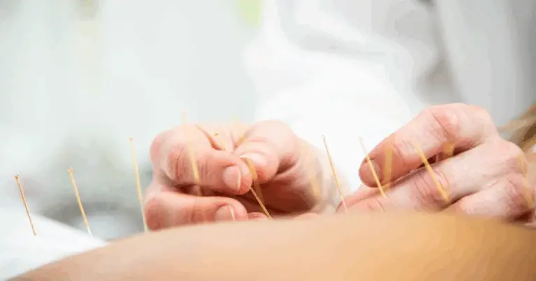 Punti di Agopuntura Ortopedici sulle Articolazioni: Una Guida Completa alla Salute Articolare