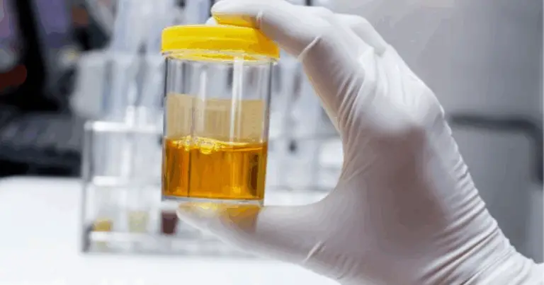 🧪 Il Colore dell’Urina: Un Riflesso della Tua Salute