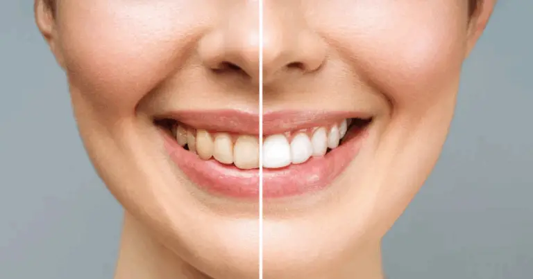 Calcio: 7 Segnali da Non Ignorare e Come Rafforzare la Tua Salute con l’Alimentazione