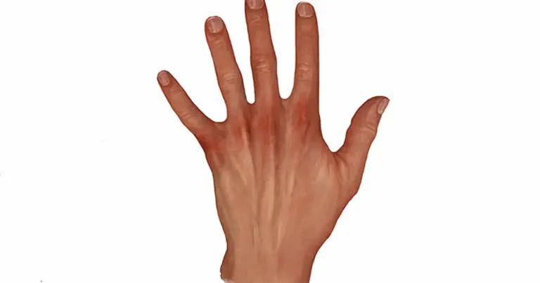 ✋ La riflessologia della mano: mappa dei disturbi e benefici per la salute