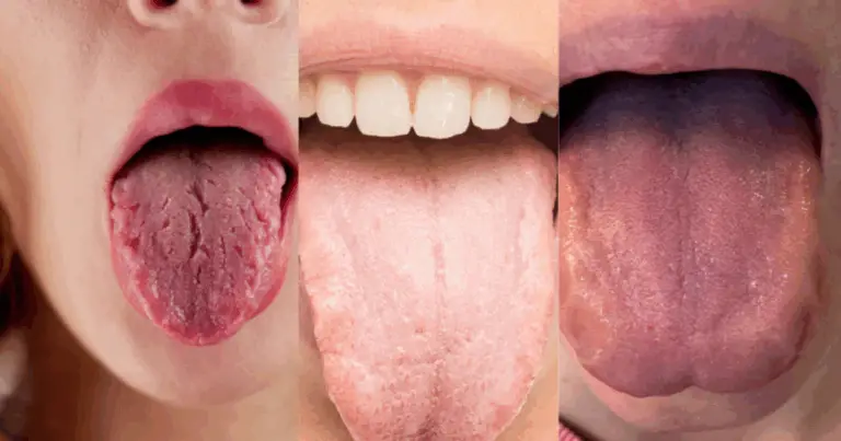 👅 Diagnosi della Lingua secondo l’Ayurveda