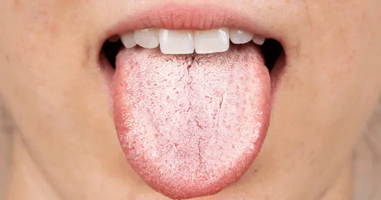 👅 Cosa Rivela il Colore della Lingua sulla Nostra Salute