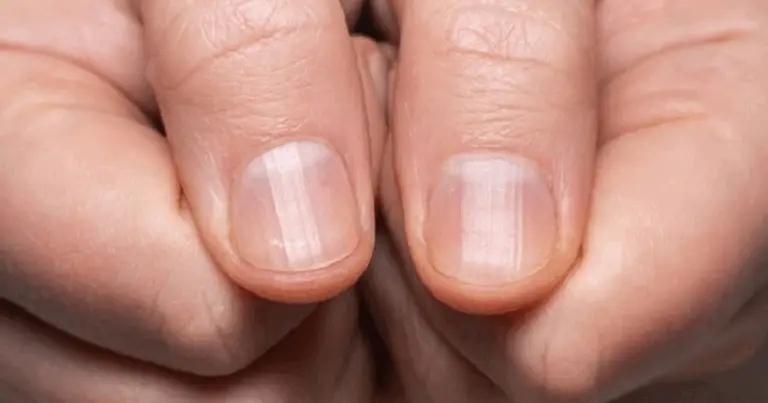 Unghie che Parlano: Guida Completa alle Patologie Ungueali e alla Salute