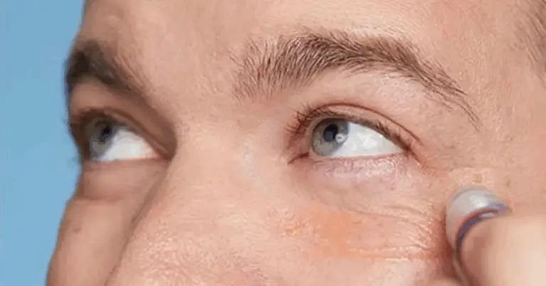 🌿 Come Ridurre le Occhiaie Naturalmente: Guida Completa per uno Sguardo Fresco e Luminoso