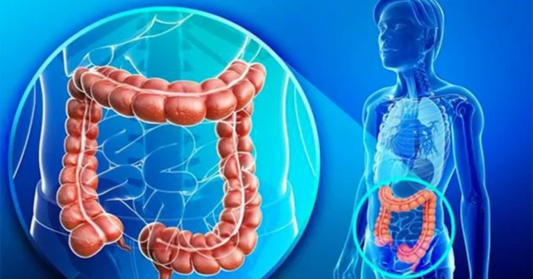 Prova Questo Mix Depurativo per l’Intestino (Una Volta al Giorno)