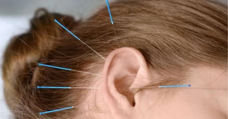 Riflessologia auricolare: come l’orecchio può contribuire al benessere naturale