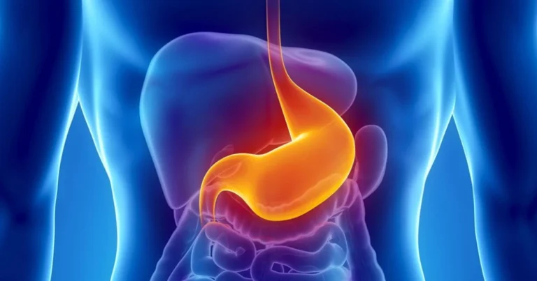 Alimenti che Aiutano a Gestire il Reflusso Acido (GERD): Soluzioni Naturali per il Sistema Digestivo