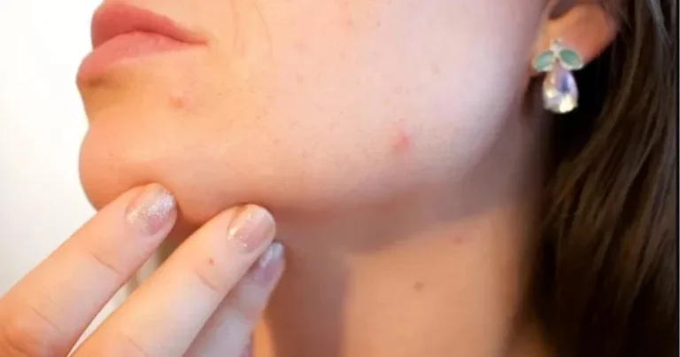 Segnali che possono indicare una carenza di vitamine: sintomi, cause e quando approfondire