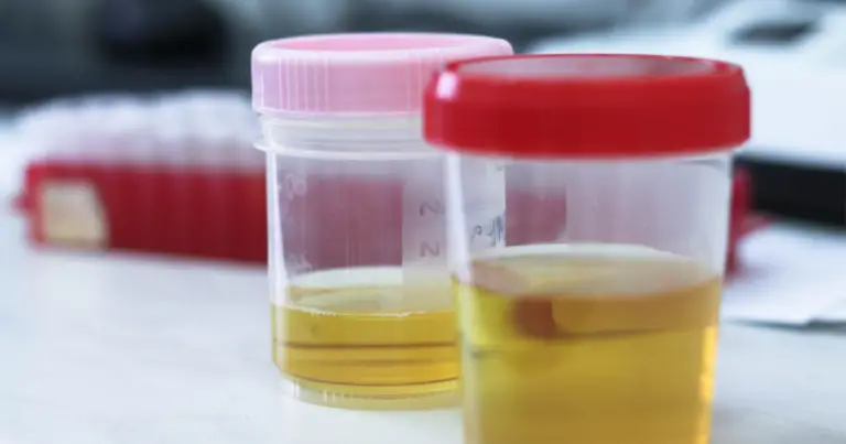 Colore delle urine e idratazione: cosa indica davvero e quando preoccuparsi