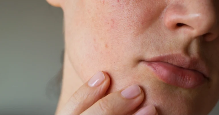 Problemi cutanei comuni: riconoscerli, comprenderli e gestirli correttamente