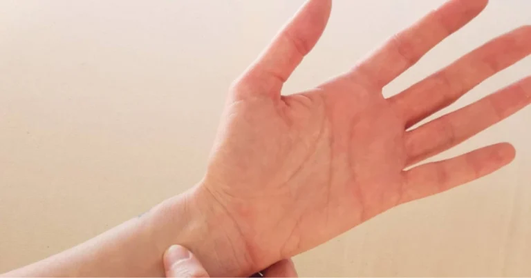 Punti di digitopressione della mano: mappa pratica, utilizzo e benefici